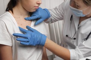 Child with measles symptoms being examined by doctor