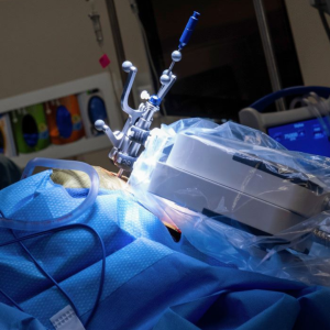 brain surgery, robotics, robot, neurosurgery